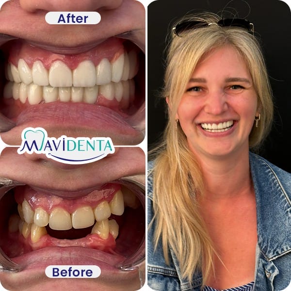 Best Dental Clinic in Turkey review