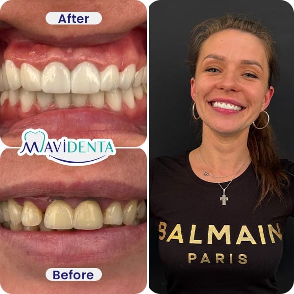 Best Dental Clinic in Turkey review