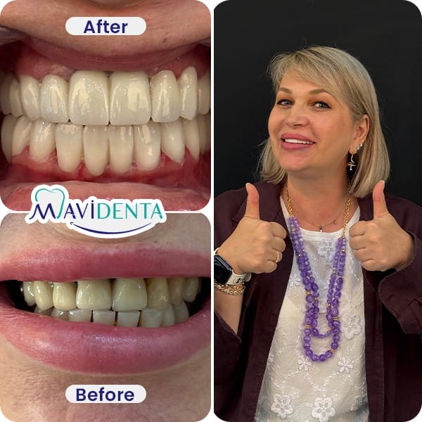 Best Dental Clinic in Turkey review