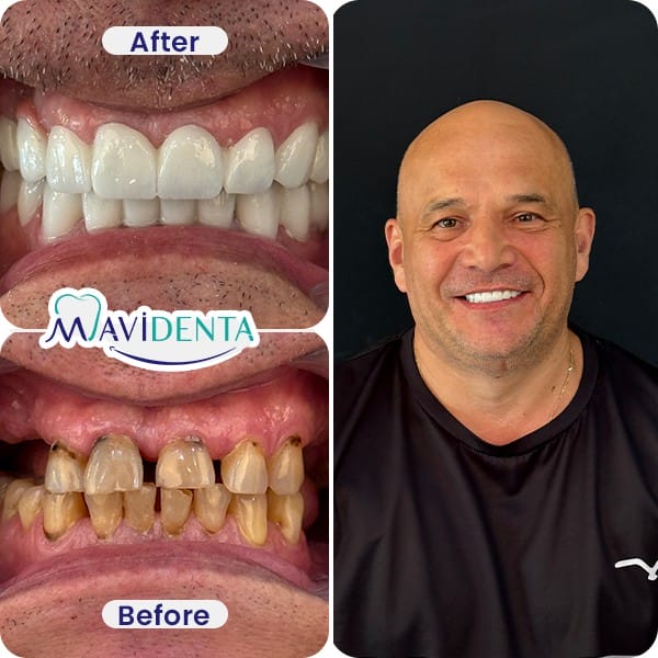 Best Dental Clinic in Turkey review