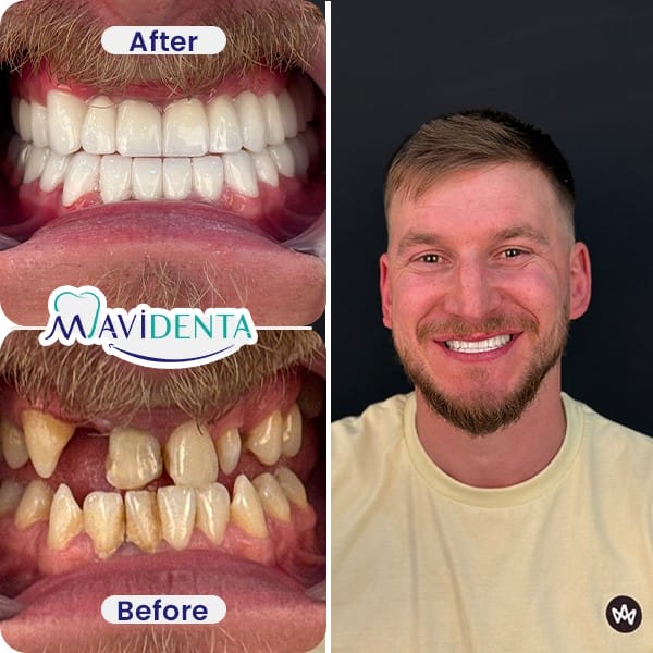 Best Dental Clinic in Turkey review